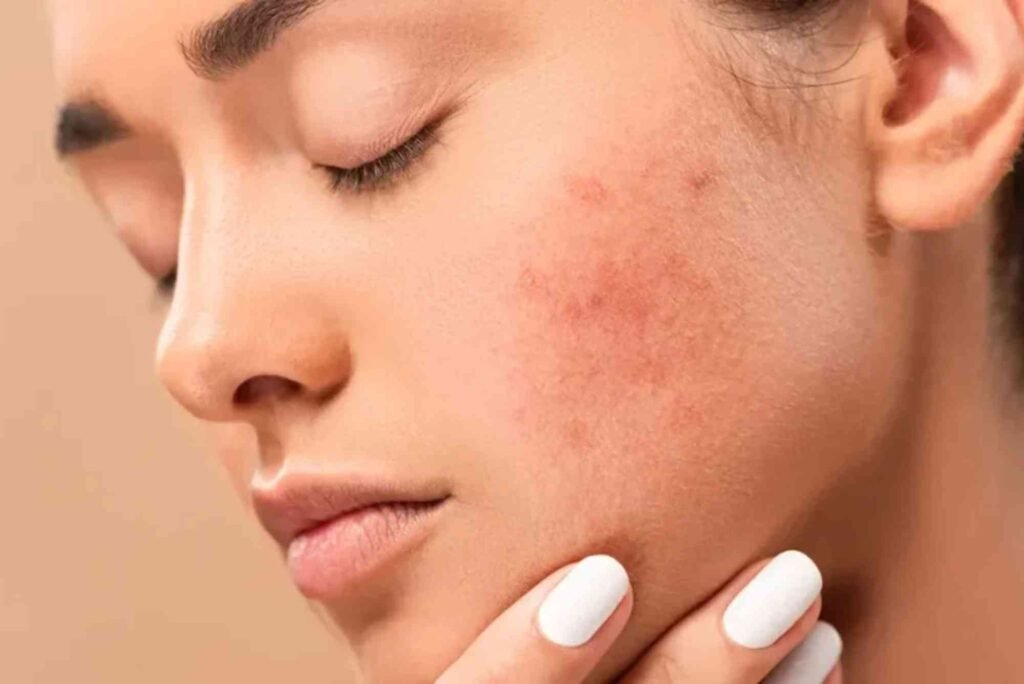 Top Mistakes to Avoid When Elevate Skincare Stockton California