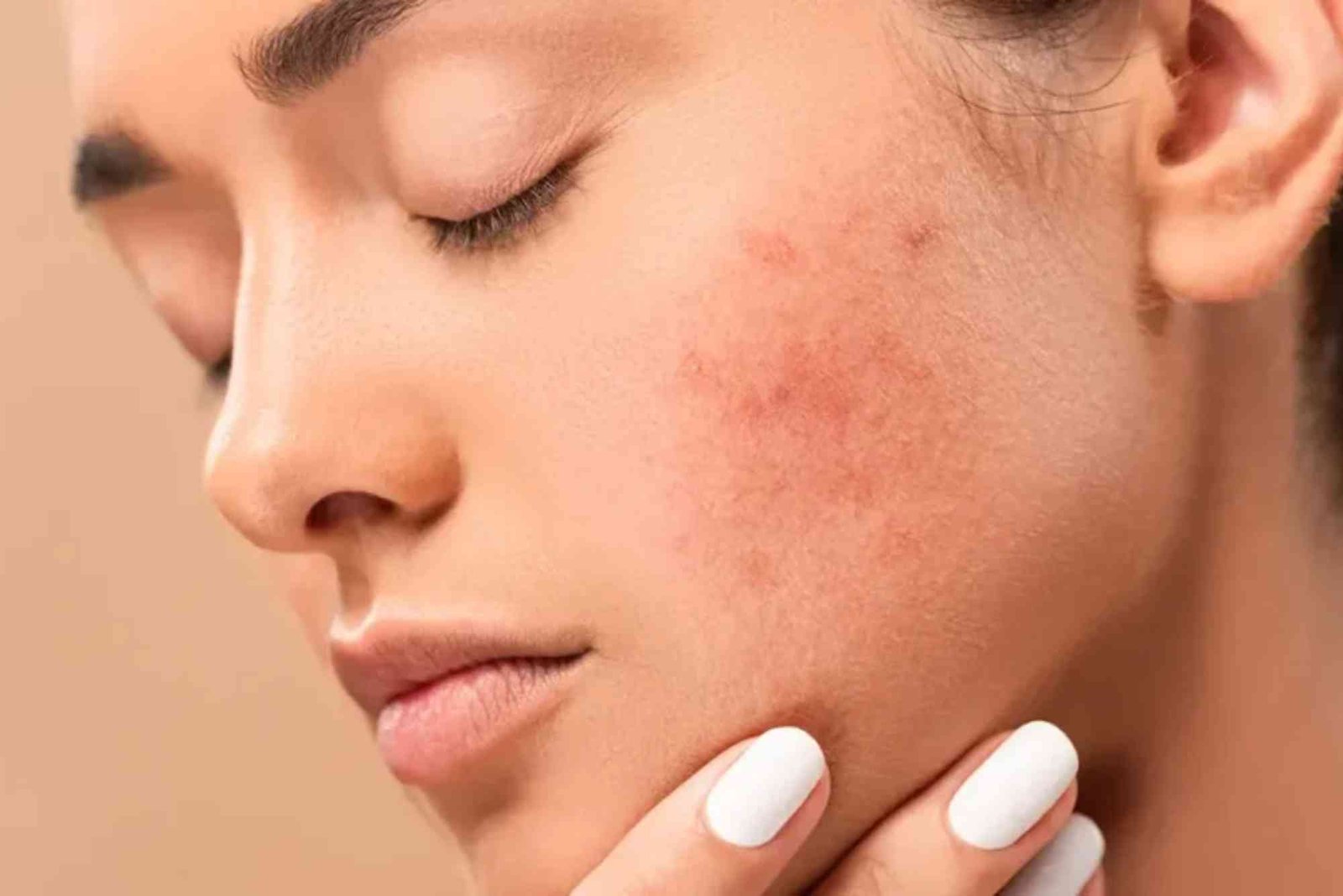 Top Mistakes to Avoid When Elevate Skincare Stockton California